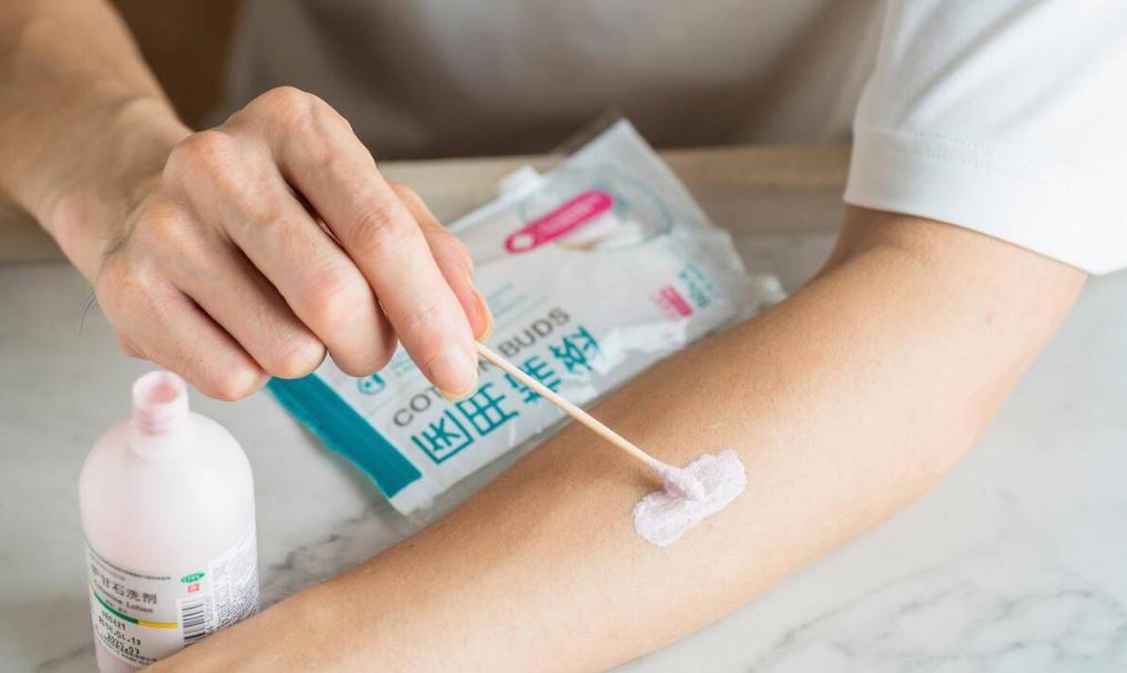 炉甘石洗剂，几块钱一瓶，却能治疗4种常见病，连世卫组织都推荐