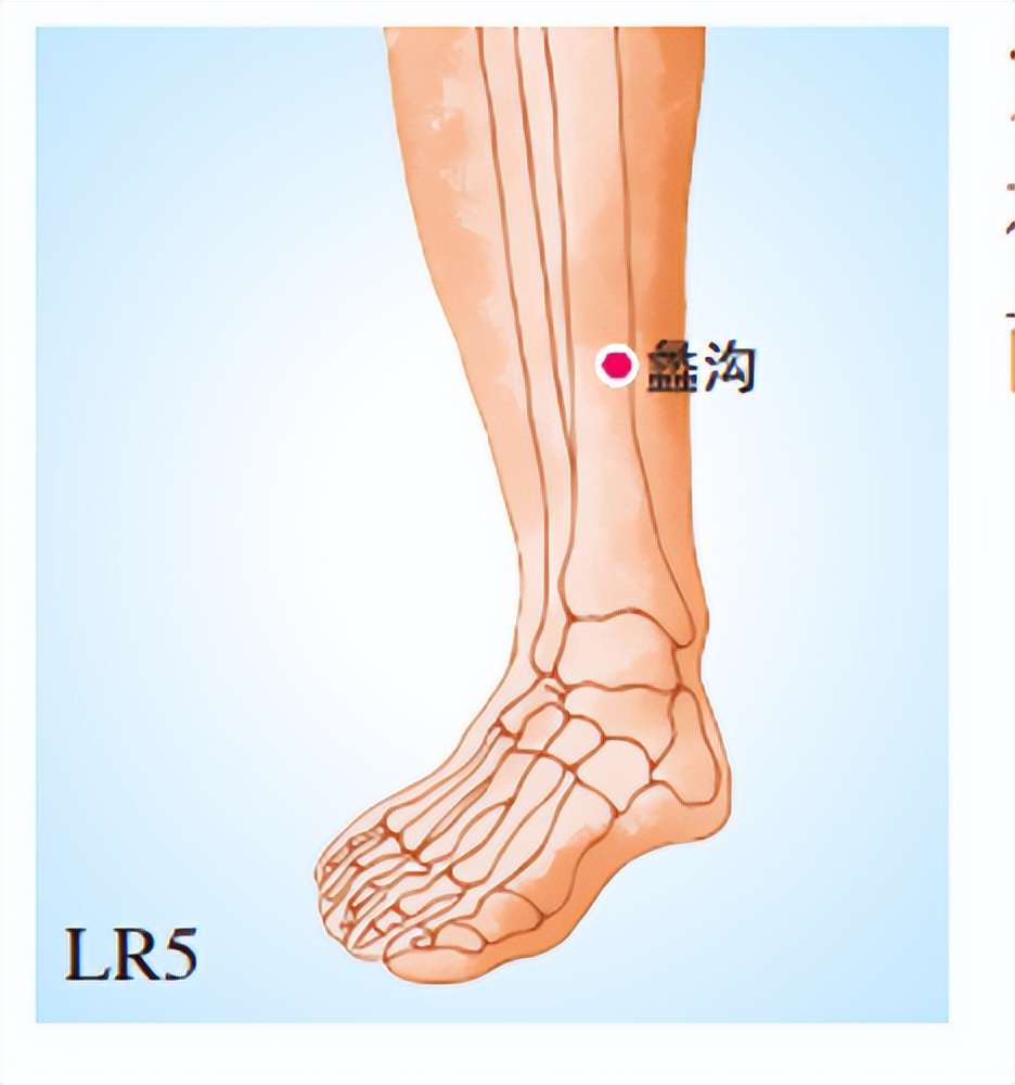 蠡沟穴——调理妇科炎症经验穴
