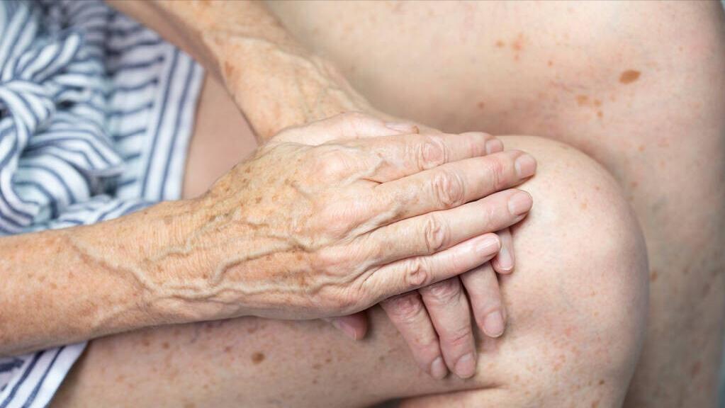 牙膏祛老年斑的正确方法,牙膏祛老年斑小偏方