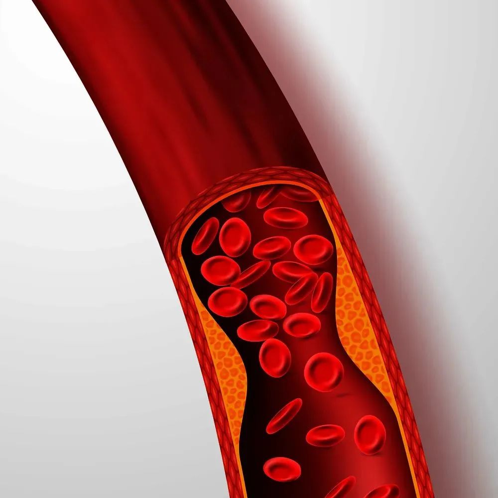 怎么合理饮食才能控制血脂,如何调理血脂才能让血脂下降