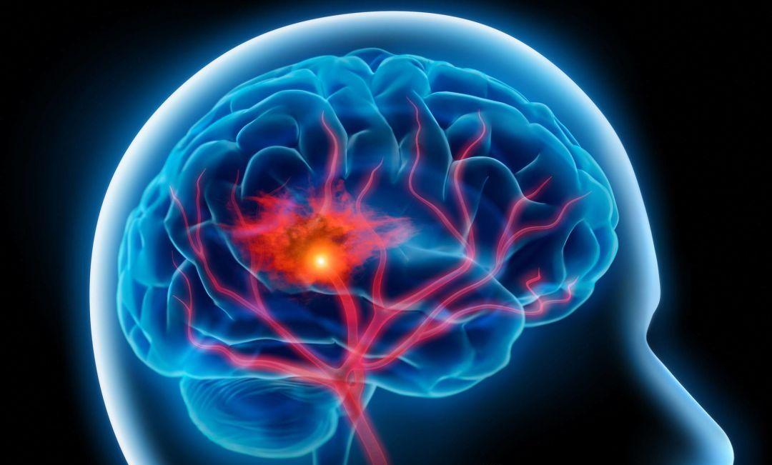 女性性欲过于强烈是什么原因？是疾病吗？医生：这几点要引起重视