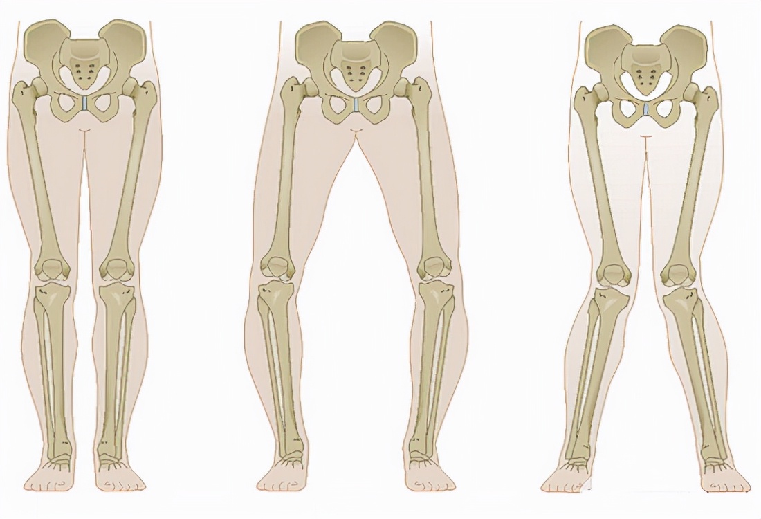 髌股关节疼痛综合征吃什么药,髌腱疼痛怎么康复