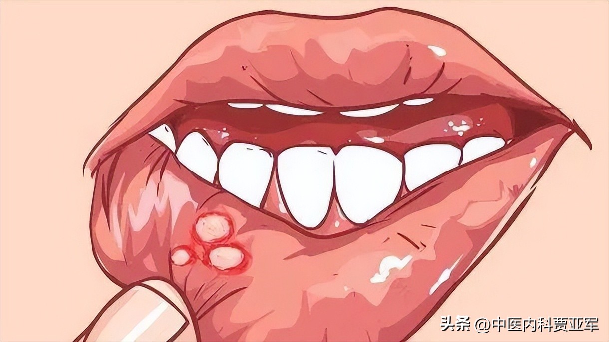 牛黄解毒片功效和作用几天见效,牛黄解毒片功效和作用多久有效