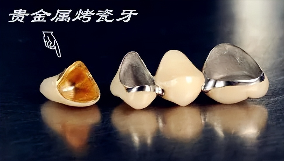 没有牙根怎么做烤瓷牙,做烤瓷牙后悔了有补救办法吗