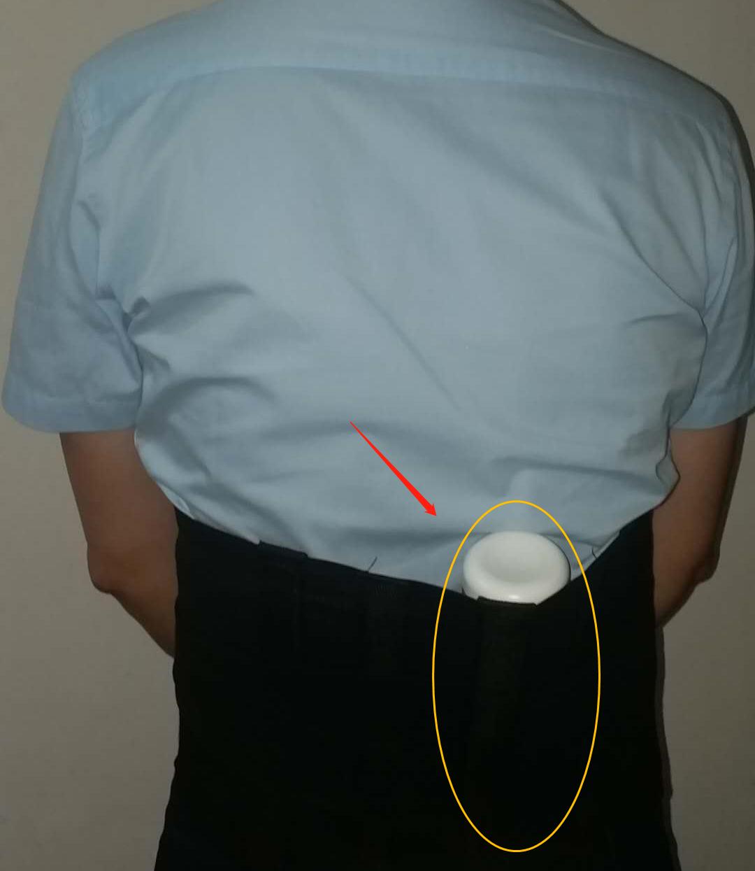 胃疼腰疼怎么缓解快速止疼,腰疼胃疼怎么治