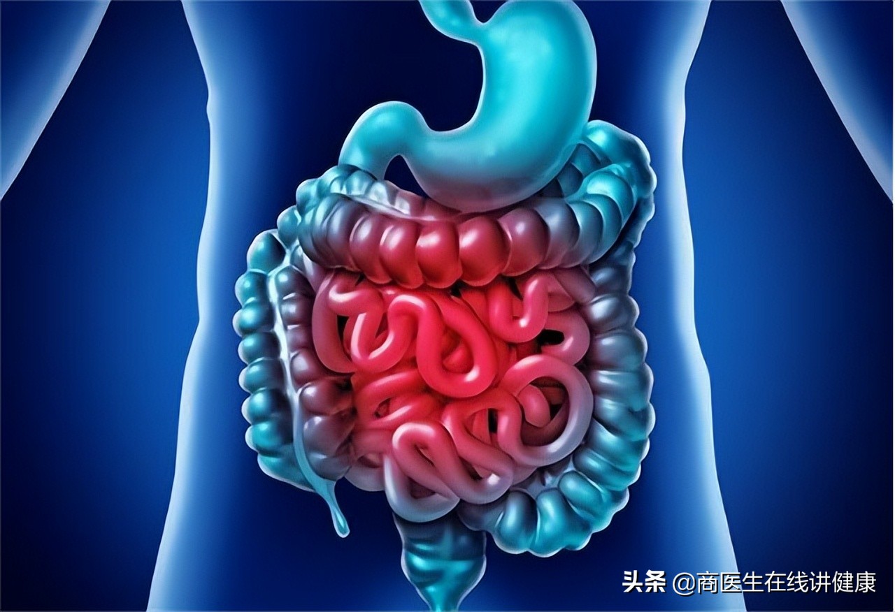 为什么会有肠道息肉,为什么肠道会长息肉