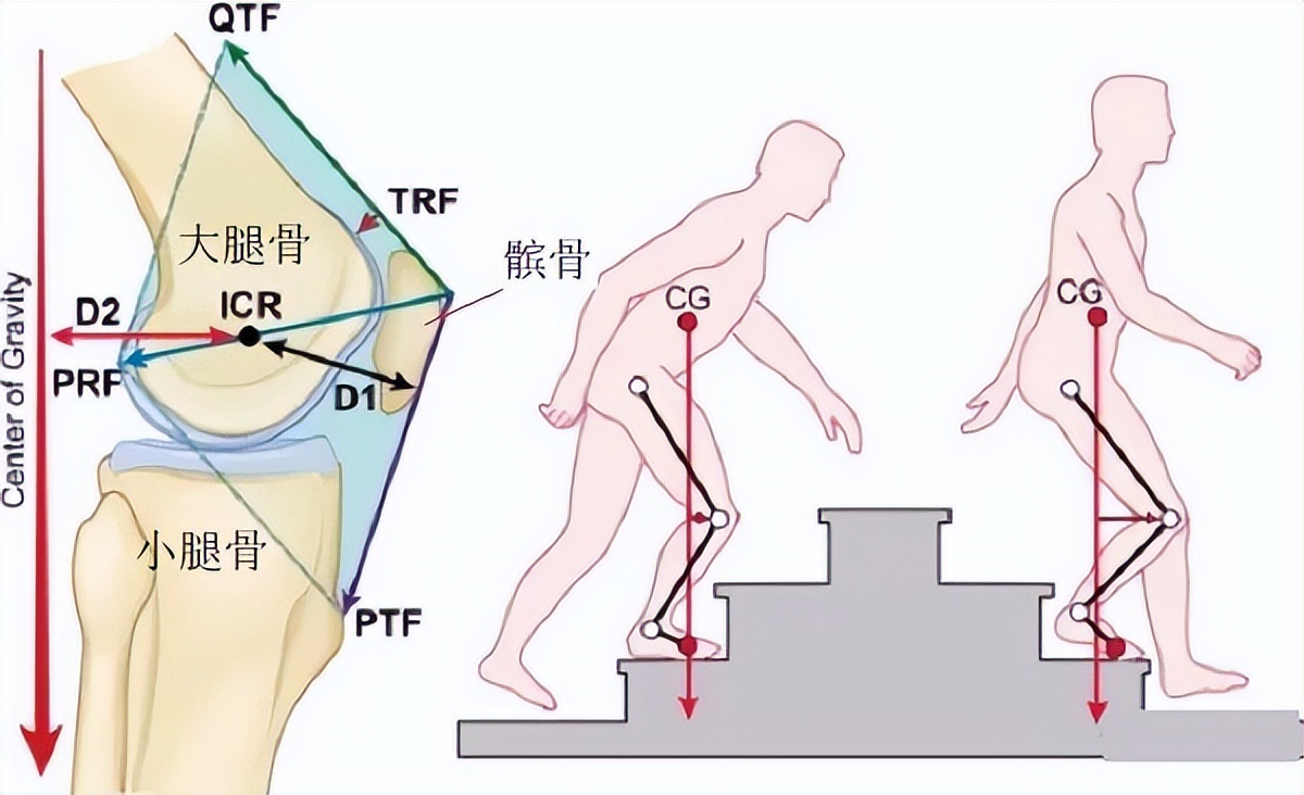 抬腿上楼梯时膝关节疼是怎么回事,上下楼梯膝关节疼痛是怎么回事