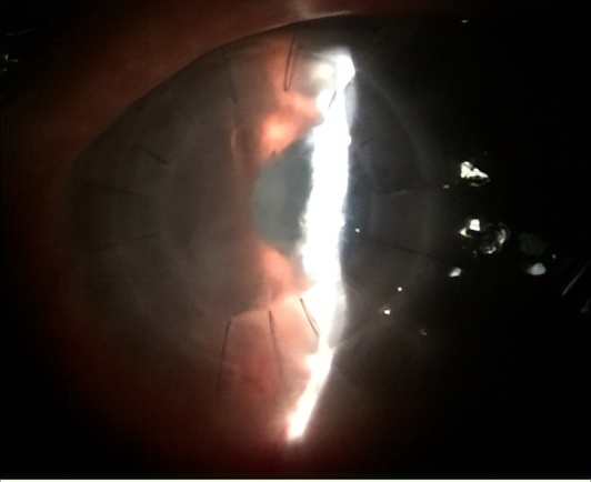 邓志宏几号坐诊,湘雅附三眼科邓志宏简历