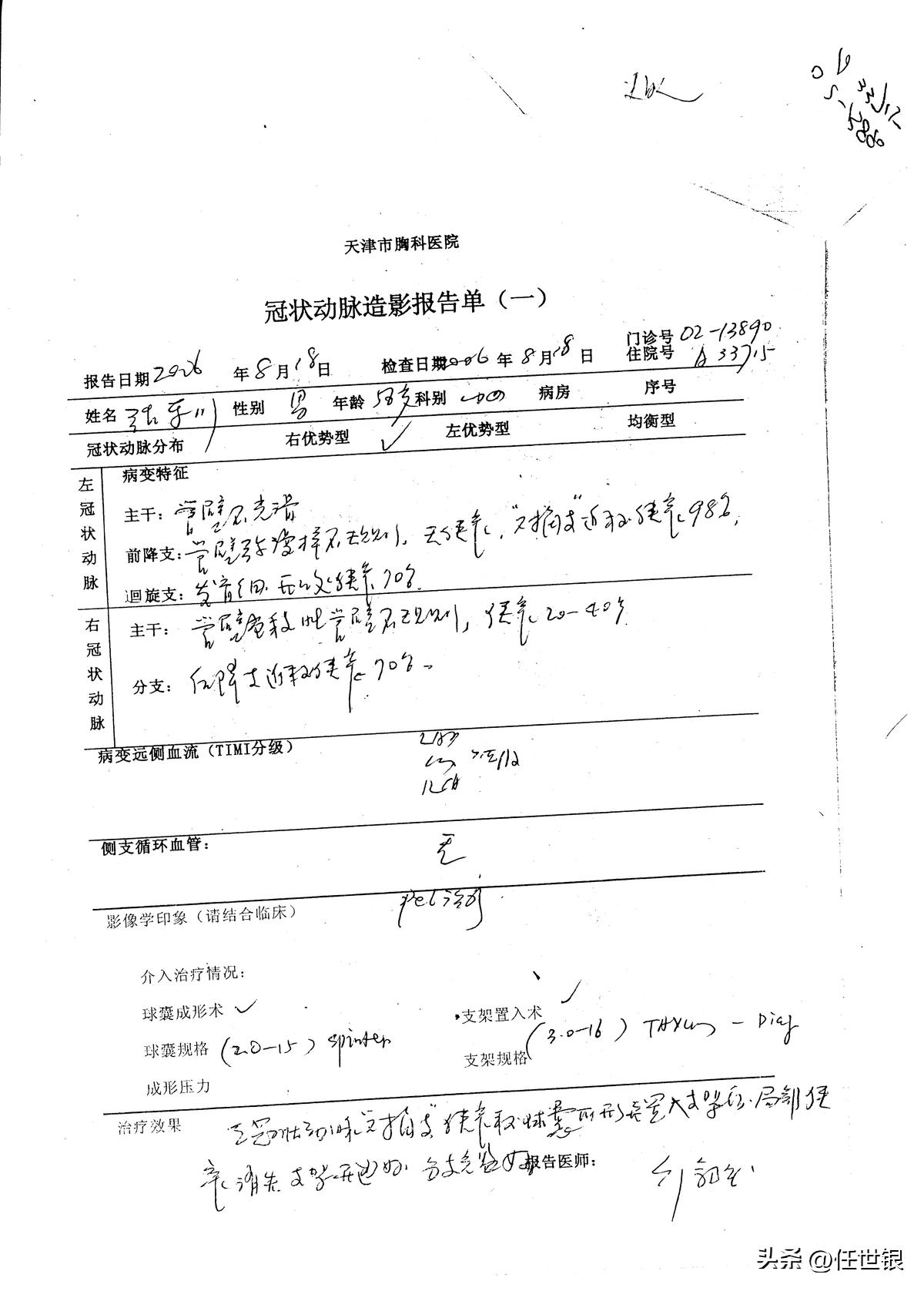 重症冠心病的新法治疗系列病例报导之四