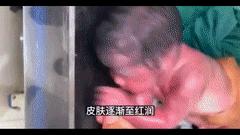 婴儿发生心跳呼吸骤停时,婴儿刚出生心脏就出现骤停