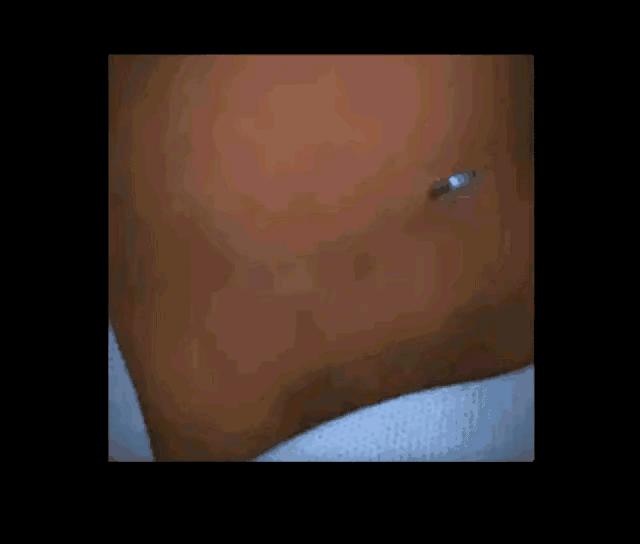 生孩子剖腹产与顺产对比,生孩子顺产和剖腹产对比