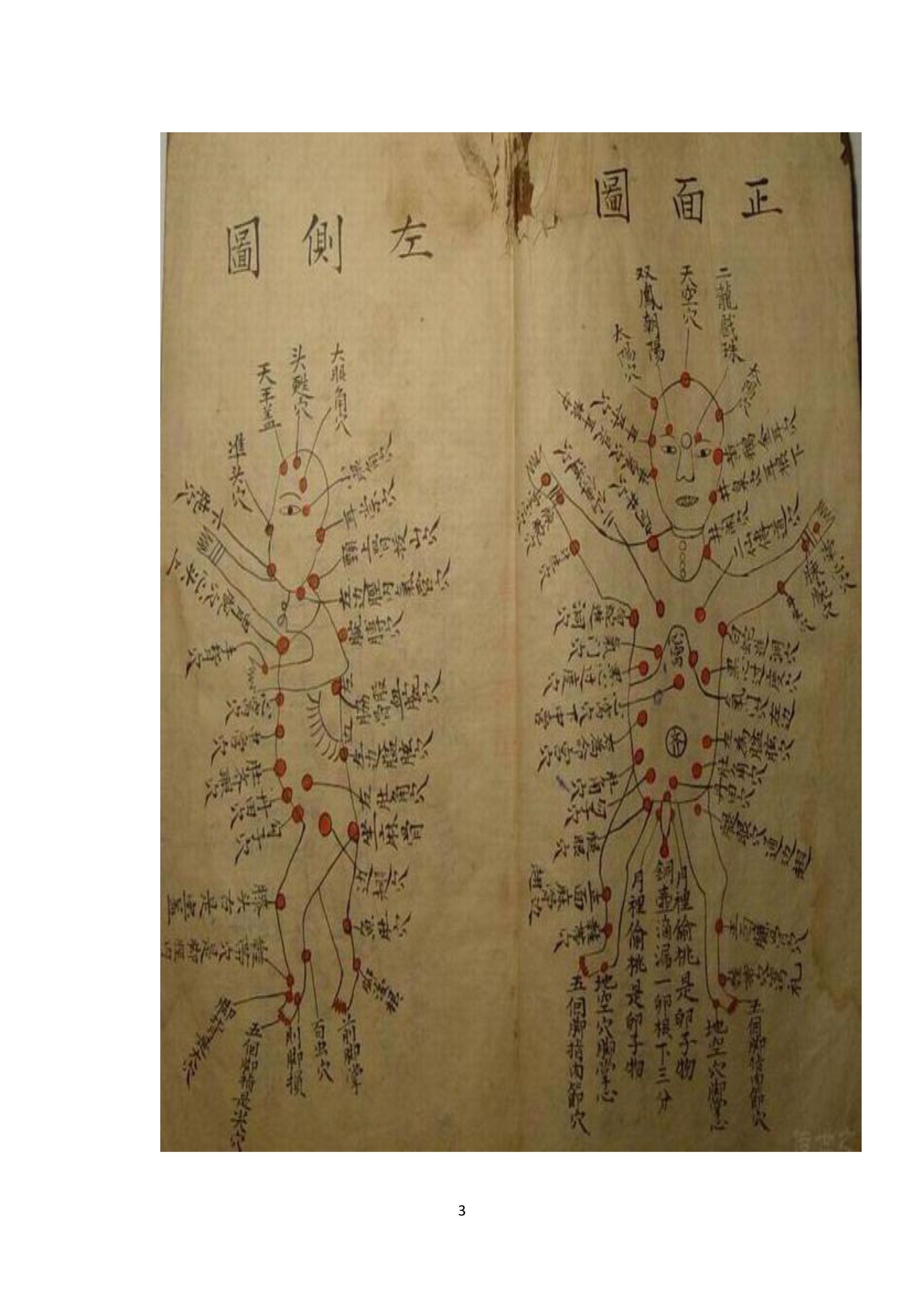 中医古书籍清代带图且内容非常好的手抄跌打损伤良方