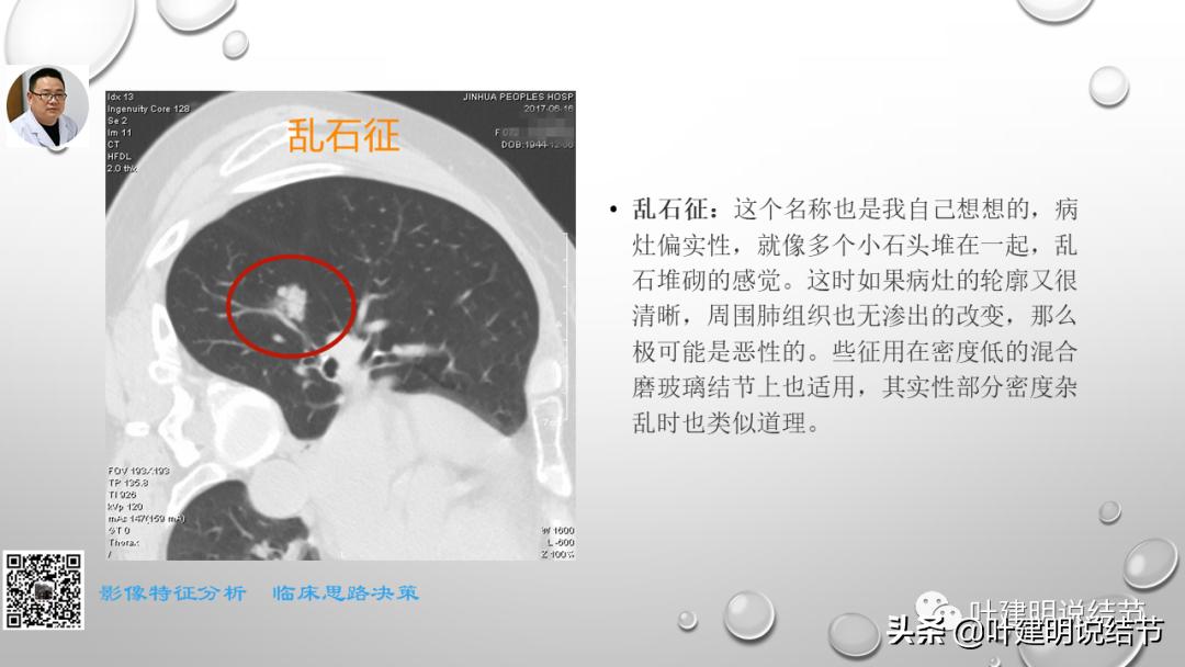 在《一脉阳光》呼吸影像诊断专题培训班上的讲课PPT（第一部分）