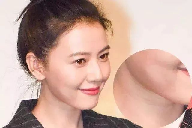 颈部保养最佳年龄,颈部保养过程中又要注意哪些问题