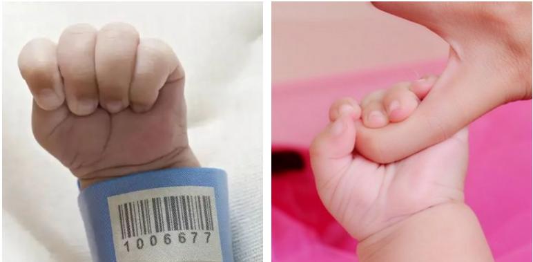 婴儿总抓破脸,婴儿老是把脸抓破怎么办