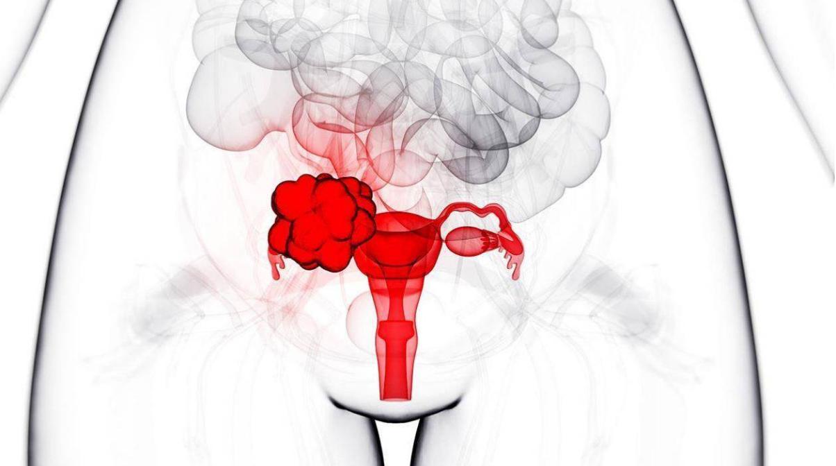 女性没了子宫，会影响“行事”？医生坦言：满意度反而提高了