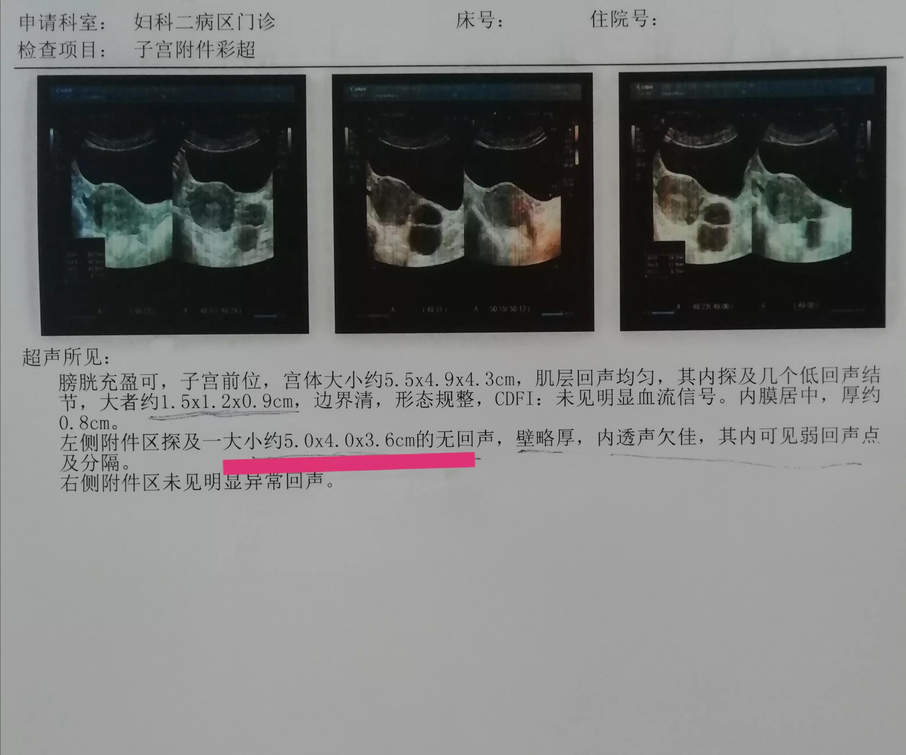 很小的囊肿能自愈吗,鼻腔囊肿必须要做手术吗