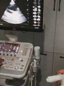 猫肥厚型心肌病分几期,猫得了hcm肥厚型心肌病