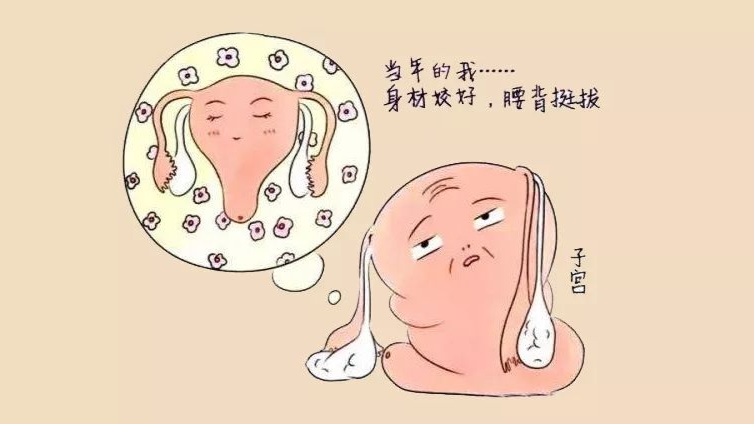 女性六十岁子宫脱垂怎么治疗,子宫脱垂一级的女性多吗