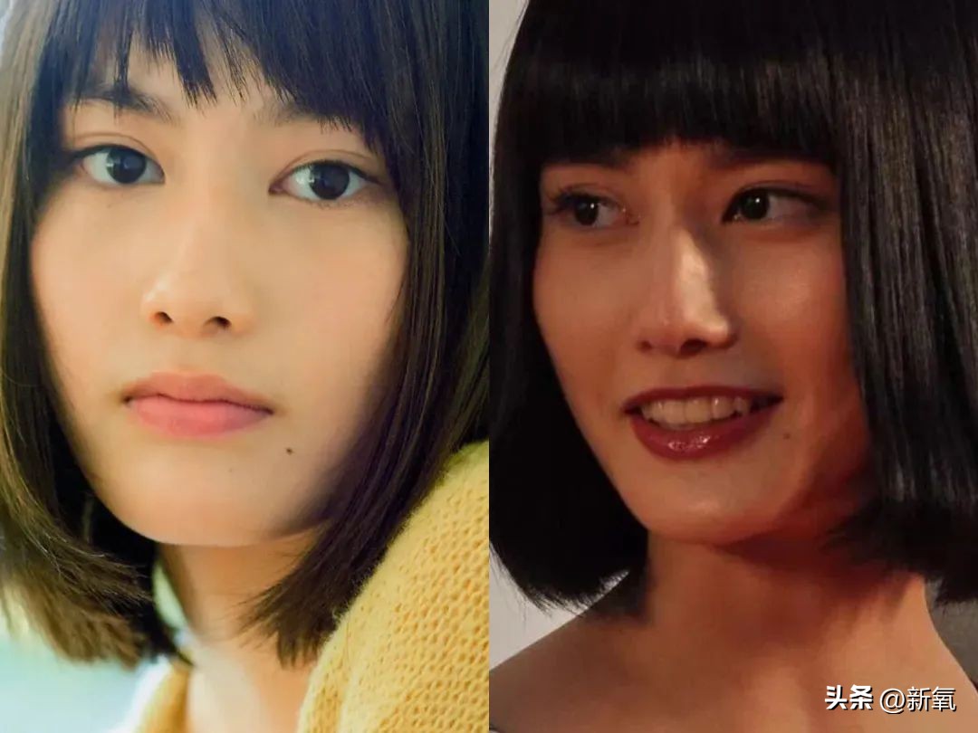 嘴唇薄变丰满,嘴唇变凸变丑怎么办