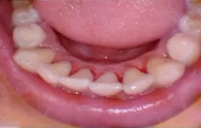 口碑最好的电动牙刷前十名飞利浦,飞利浦牙刷头2023和9021