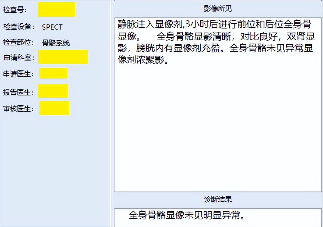 二阳一阴乳腺癌用什么化疗药好,乳腺癌弱阳是不是吃托瑞米芬