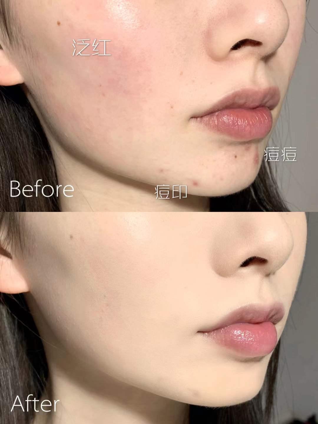 十大公认好用的粉底气垫,ysl皮革气垫和兰蔻菁纯气垫