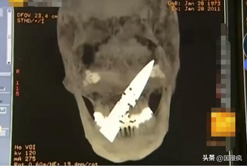 女子按压颈部致丈夫死亡获刑,女子按压颈部致丈夫死亡案疑点