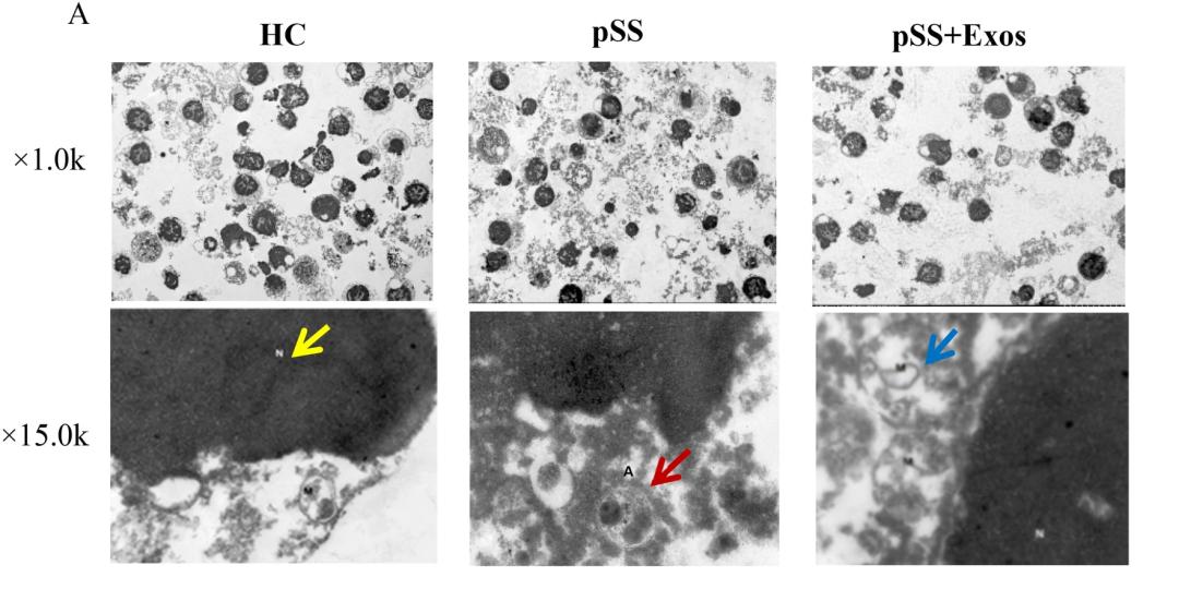 渐冻症腰椎手术报道,渐冻症患者寿命长的视频