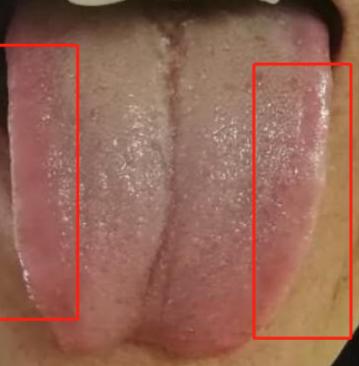 失眠4种中成药解决你的睡眠难题,失眠彻底治愈的七大方法