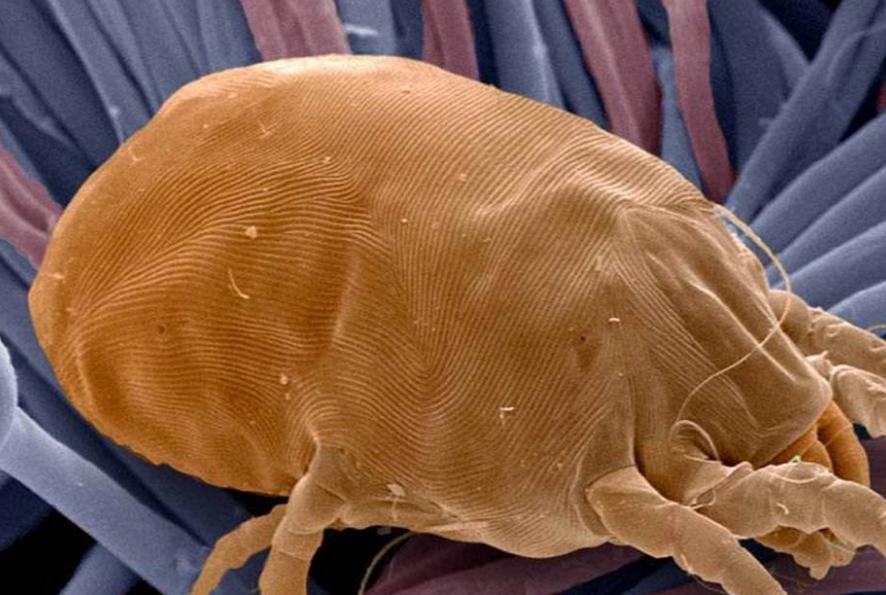 耳朵总是痒痒是身体哪里出问题了,耳朵经常痒得很是什么原因