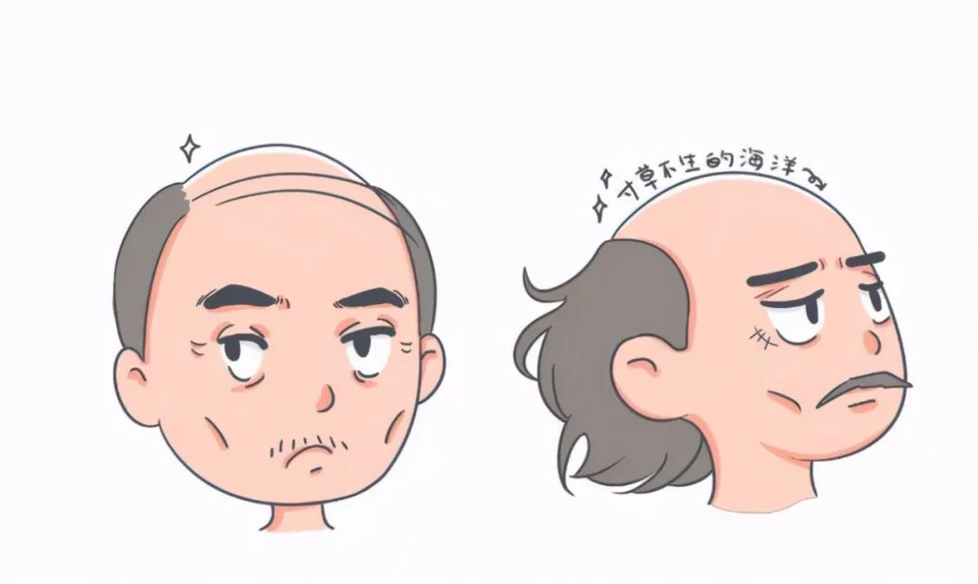 发际线头发稀少吃中药能调节吗,中医治发际线最好的方法