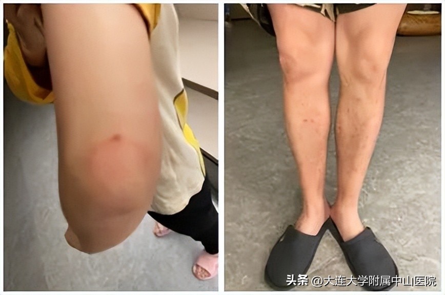 【战疫回忆】“疫”路同行情意更浓