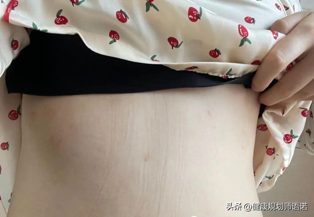 因宫颈问题走进阳光森林，用营养拯救了整个家族的健康