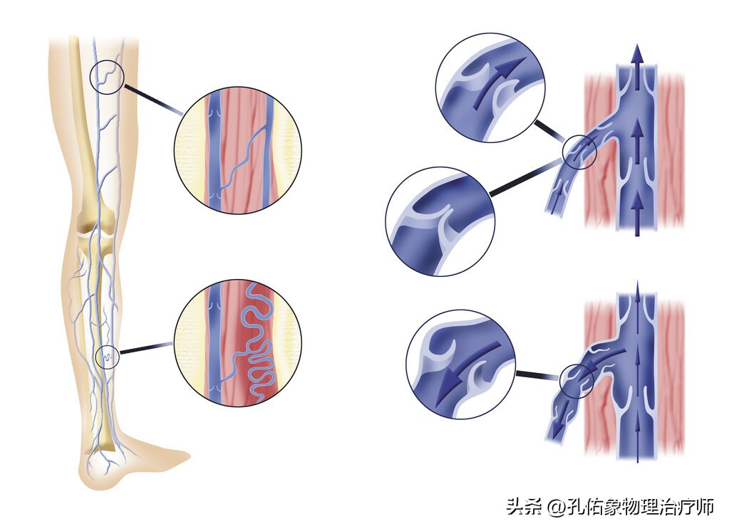 脚部信号透露健康问题,脚部出现这6种症状