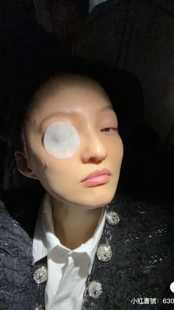 张韶涵卸不掉的睫毛胶水,张韶涵同款睫毛胶水