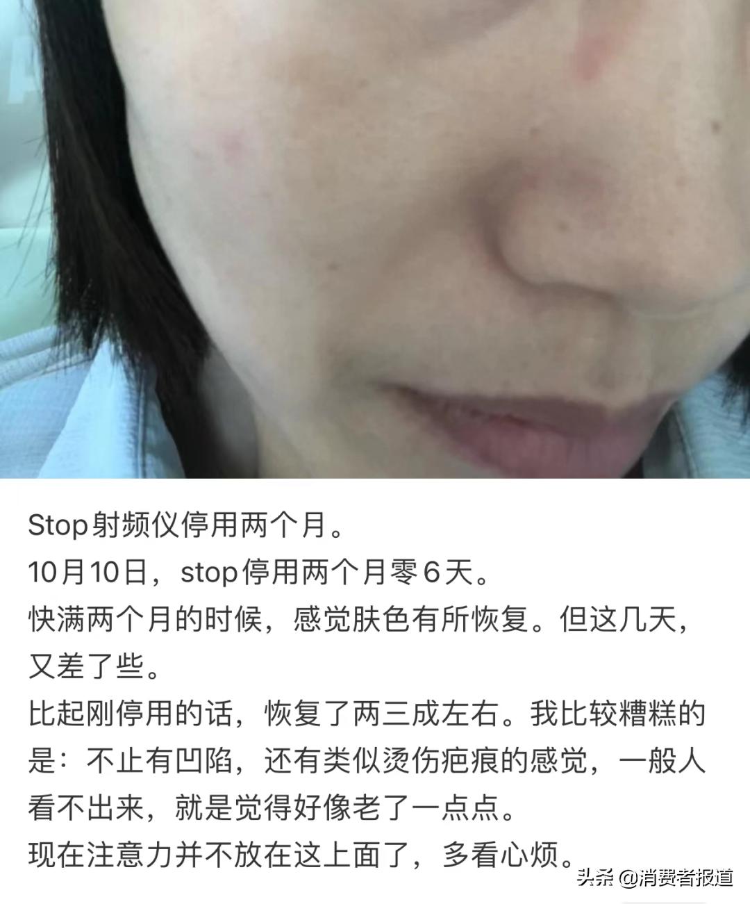 美容仪维权,美容仪器坏了怎么维权