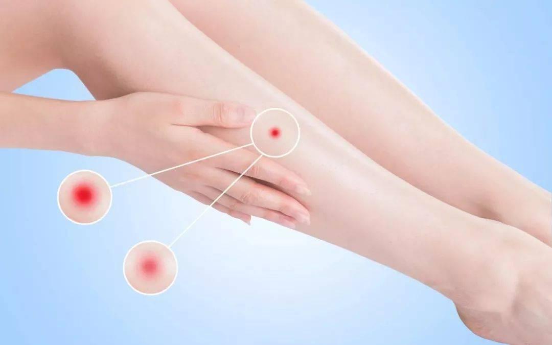 维生素b6，一旦缺乏有多可怕？提醒：皮肤出现几种异常，适当补充