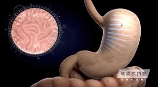 胃不舒服胃酸应该怎么办,胃不舒服胃酸怎么缓解