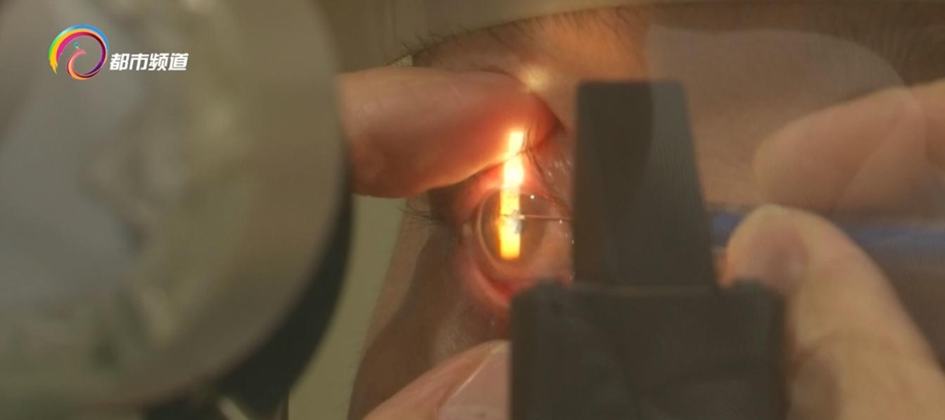 冬季天气干燥警惕相关眼病,冬季如何预防干眼病