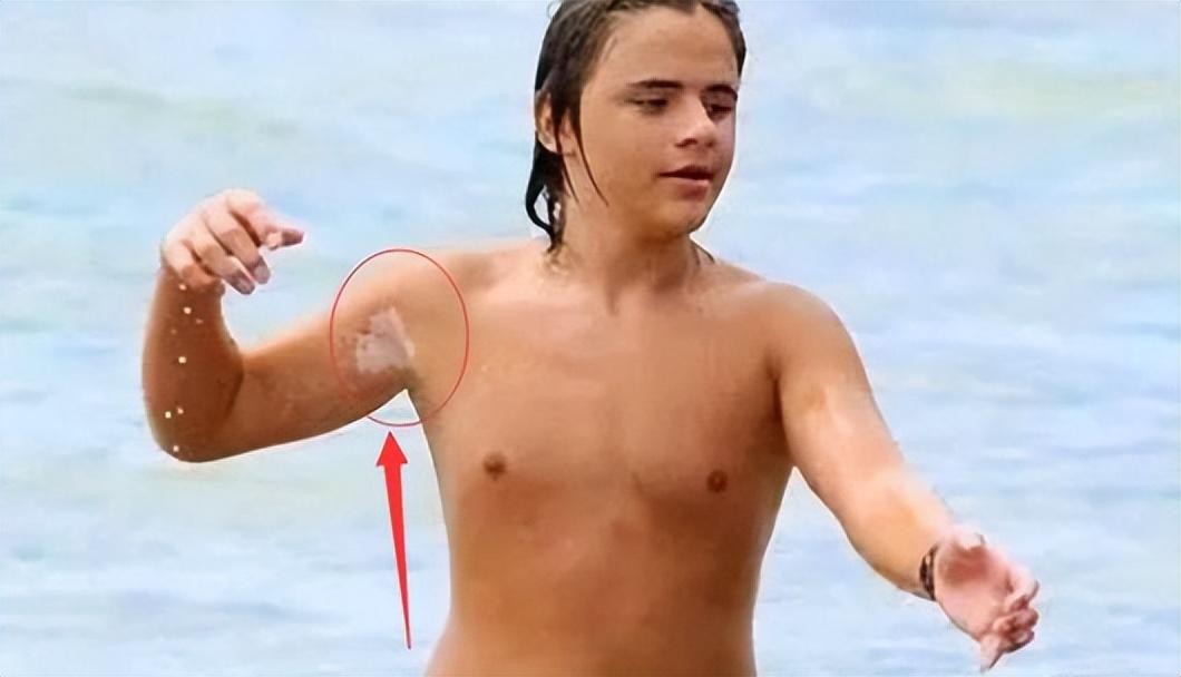 2009年杰克逊去世：长子遗传白癜风，女儿14岁被侵犯，幼子最像他
