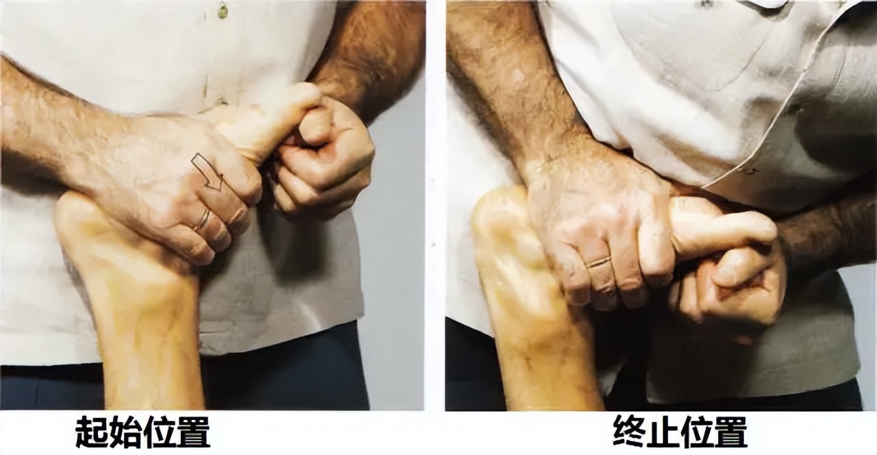 足部护理足跟痛,脚后跟粉碎足外翻怎么治疗