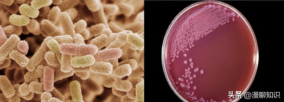 大肠杆菌的结构名称,大肠杆菌菌株基因型