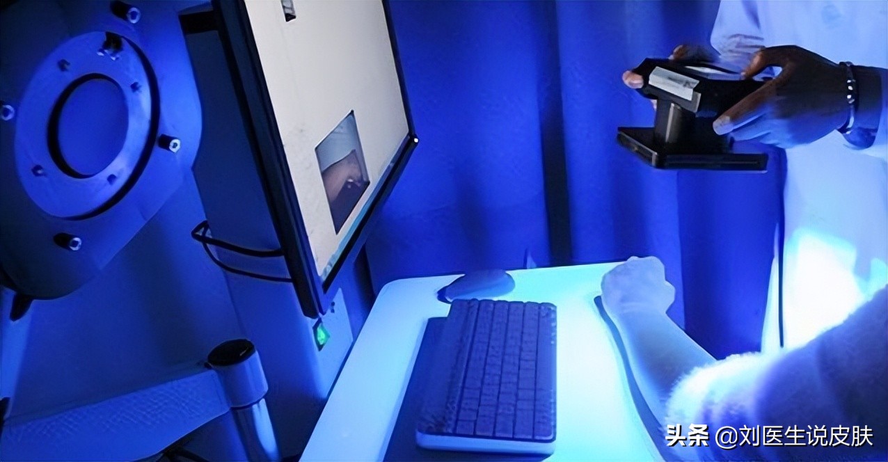 什么是白癜风和白斑有什么区别,是不是白癜风长在手上比较难治