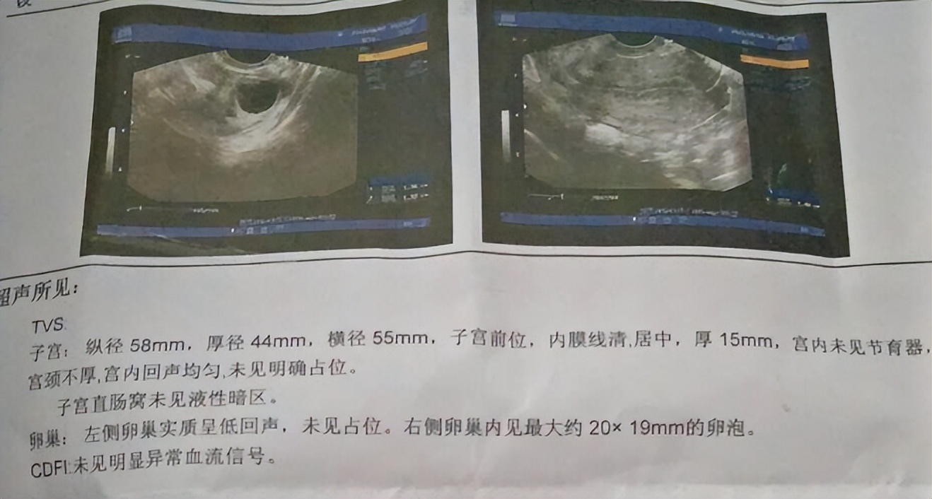 子宫内膜增厚是癌症的征兆吗,子宫内膜增厚是子宫癌症的前兆吗