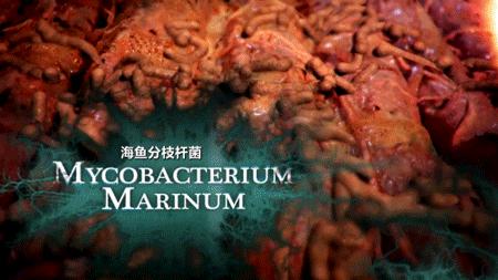 他得了什么病,他得的什么病