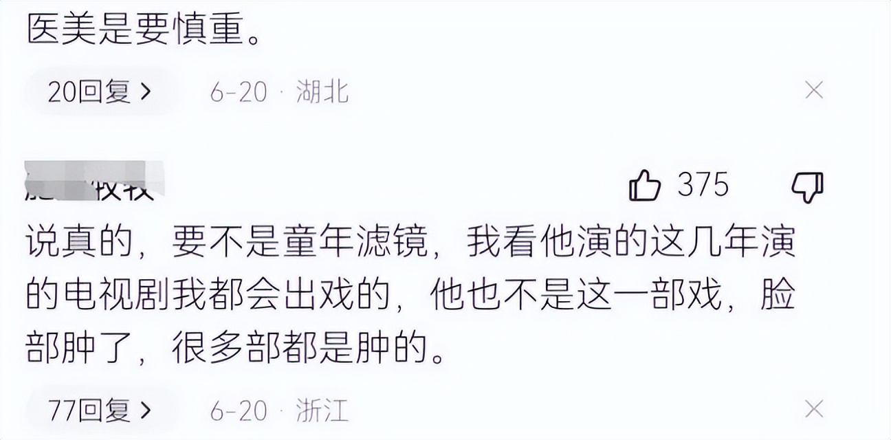 那些扮丑年轻却美若天仙女明星,曾经被嫌弃长得丑的女星