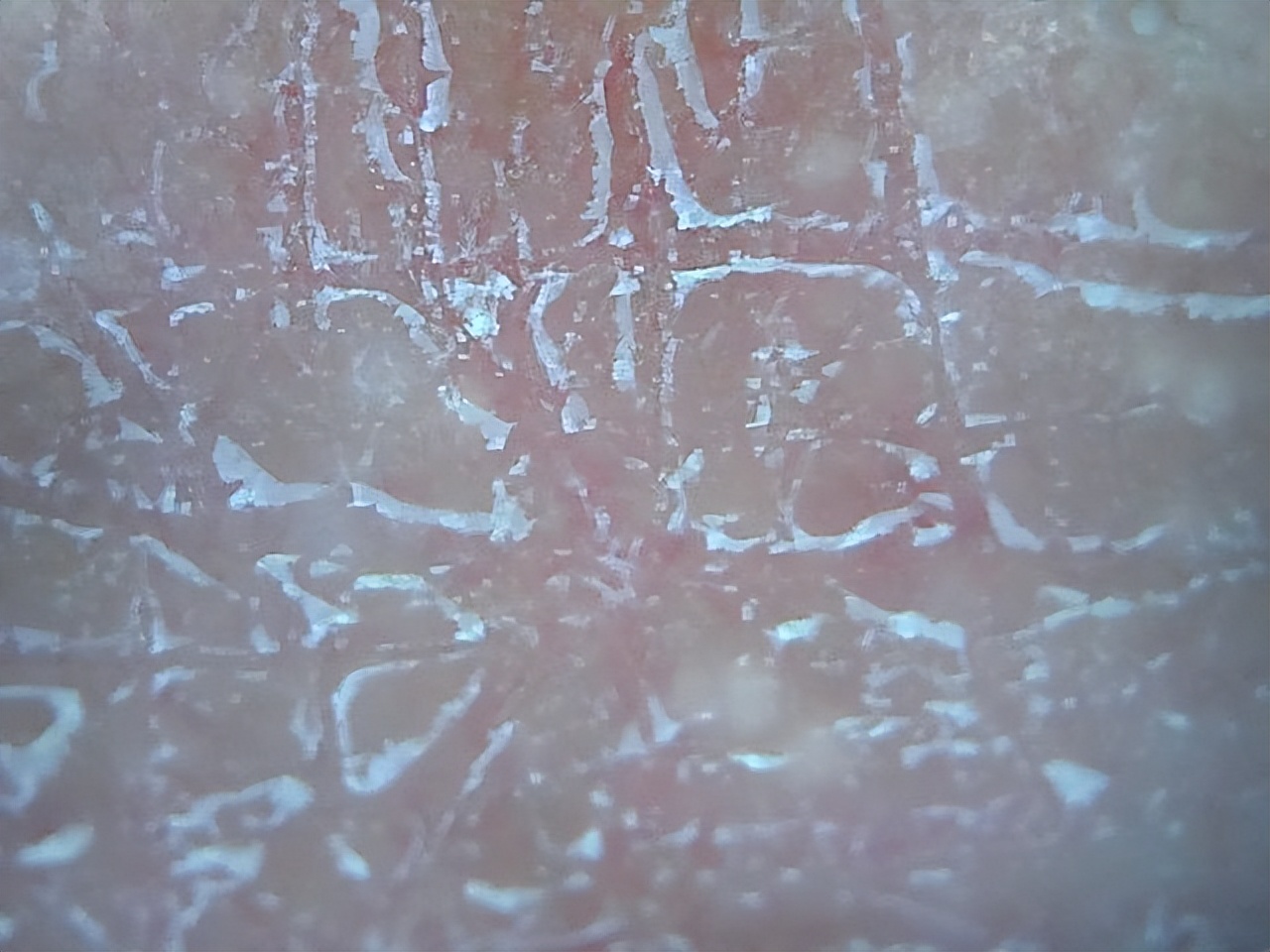 男生脸上很多处脱皮怎么办,男生脸上脱皮干燥