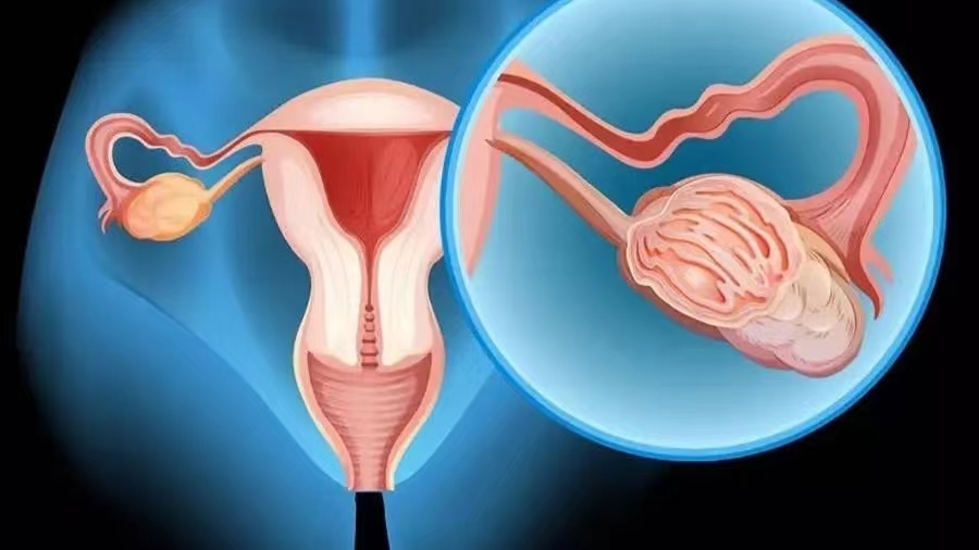 24岁女子体检发现有两个子宫,女子婚前体检却显示怀孕2个月