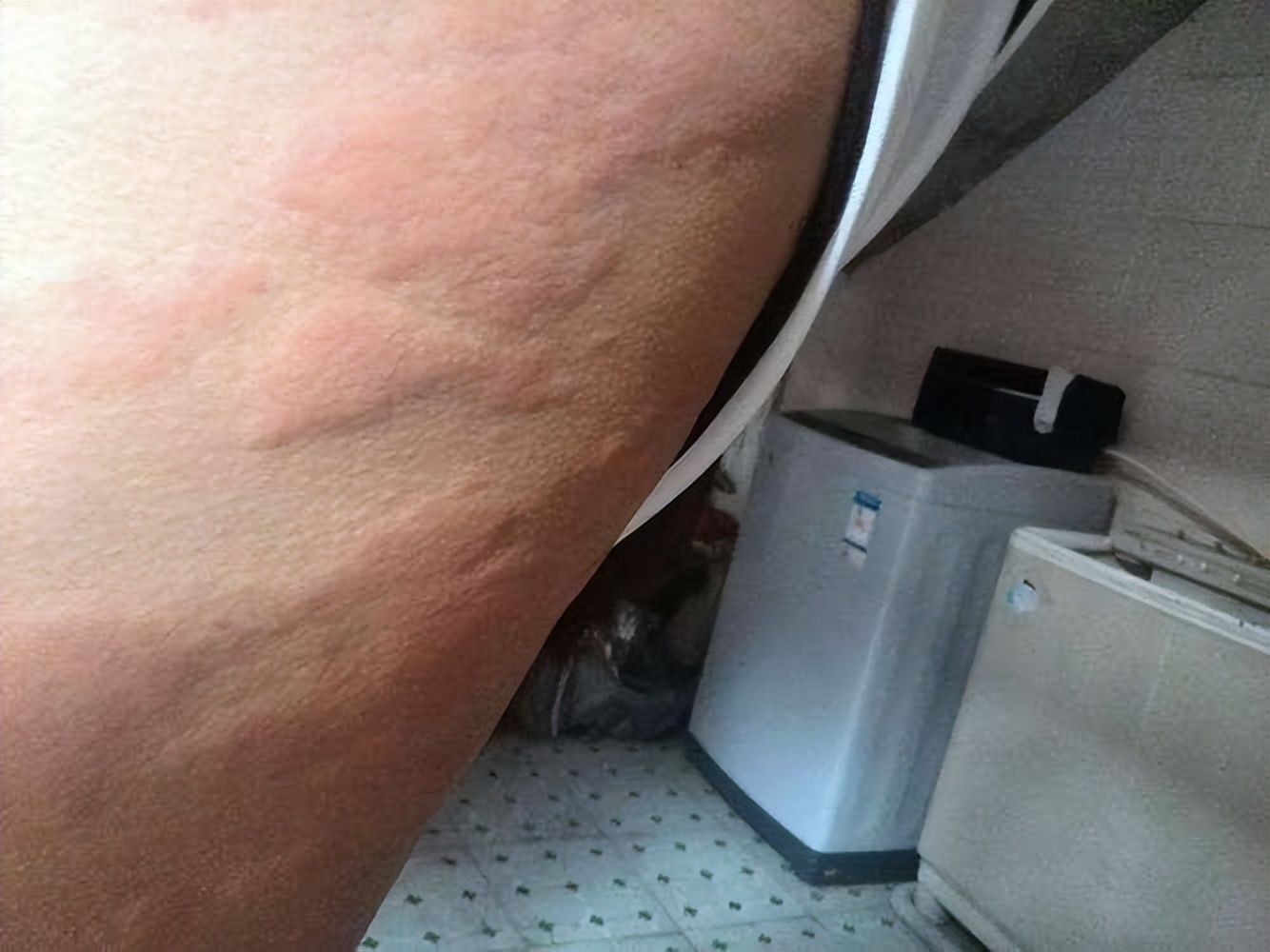 保护胃黏膜和肠道粘膜的食物,食物保护胃粘膜